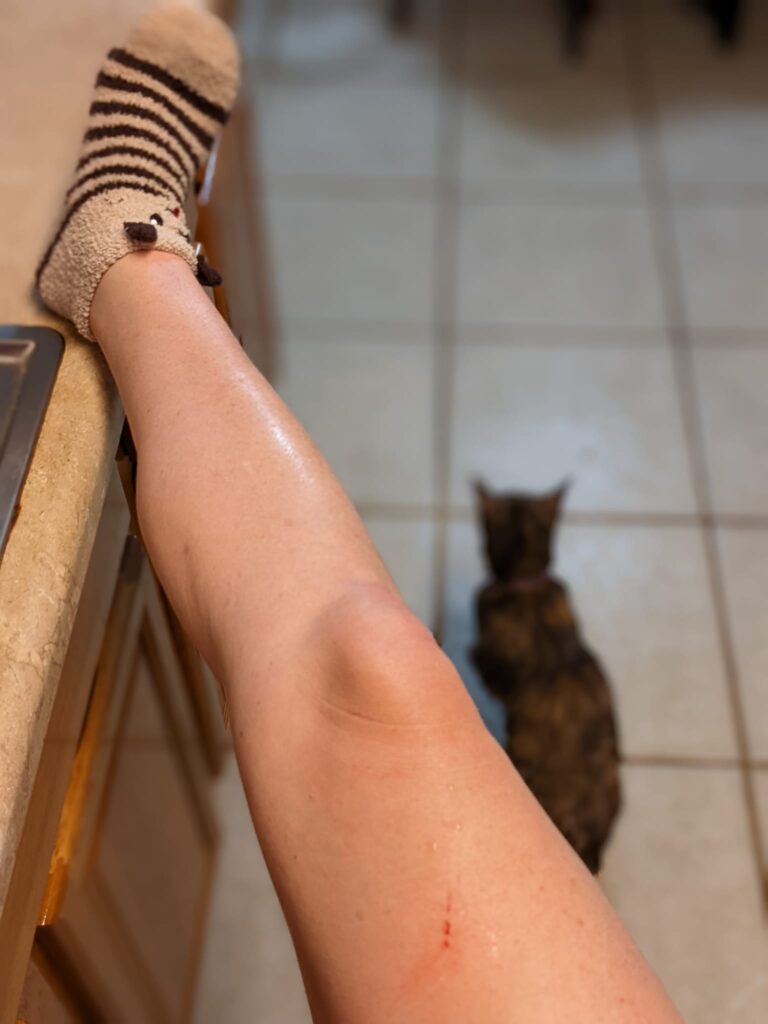 a leg is propped up on a counter to show a scratch and a cat is blurry in the distance